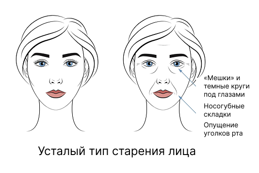 Усталый тип старения