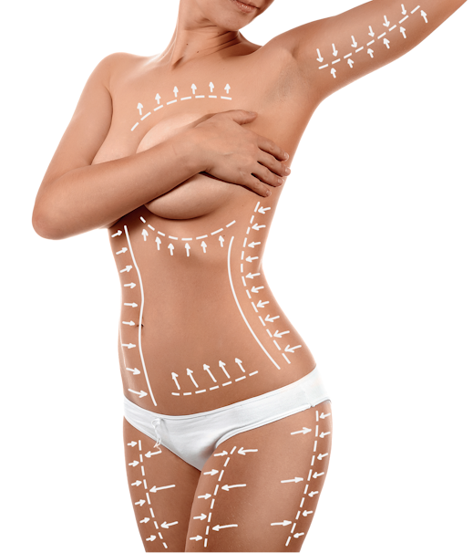 Липоскульптурирование – Пластика тела, фото