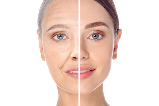 Мускульный тип старения кожи