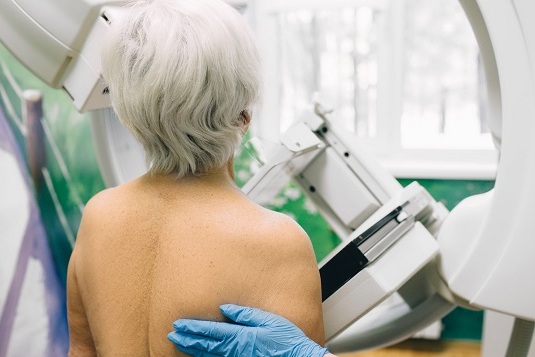 Классификация инволюции молочных желёз Классификация инволюции молочных желёз