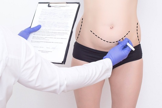 Как убрать «жировые ловушки»? Как убрать «жировые ловушки»?